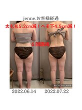ジェンヌ(jenne.)/痩身経過