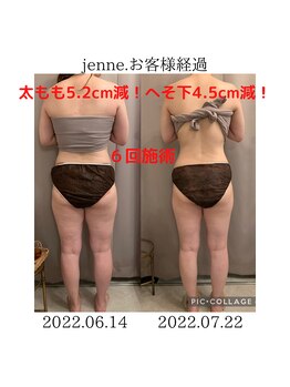 ジェンヌ(jenne.)/痩身経過