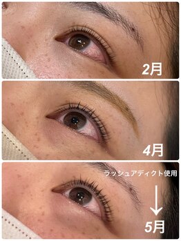 エステティック エルローザ(Esthetique elle Rosa)/アディクトカール