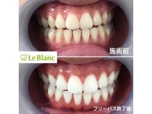 ルブラン 奈良店(Le Blanc)/【お得なコースございます！】