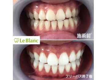 ルブラン 奈良店(Le Blanc)/【お得なコースございます!】