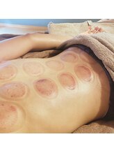 プルトア/二回目以降のカッピング痕