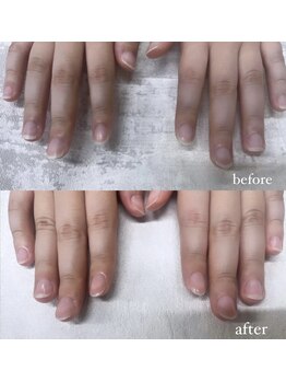 プティットスリール 西尾店(Petit Sourire)/〔 自爪ケア 〕