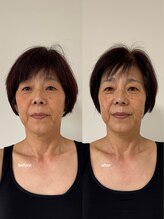 こつこつラボ サンイチマル オオル(310/OOL') 施術 美容整体