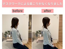 クオリア整体院 八王子(Cuoria整体院)/デスクワークによる肩こり改善