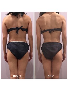 ナレル(narrel)/(新潟市/骨盤/痩身/ダイエット)