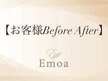 エモア メディカル整体院 恵比寿院(Emoa)/ お客様　Before After