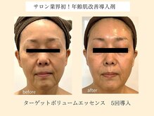 パンセリーノ(Panselinos)/業界初！老け見え対策導入剤