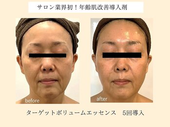 パンセリーノ(Panselinos)/業界初！老け見え対策導入剤