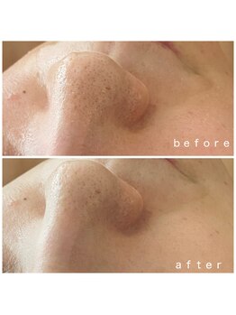 メナードフェイシャルサロン 岐阜茜部/健やか肌