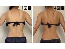 ユヴィラ(YUVIRA)/肩甲骨・お腹周りスッキリ♪