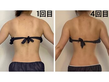 ユヴィラ(YUVIRA)/肩甲骨・お腹周りスッキリ♪