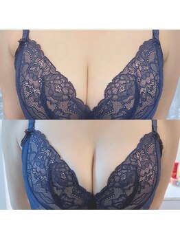 スナグル(Snuggle)/バストアップ♪