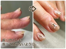 爪のコンプレックスと向き合うネイルサロン