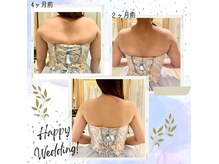 ティアエ(T-ae)の雰囲気（ドレスに映える背中、二の腕、美姿勢、デコルテお任せ下さい！）