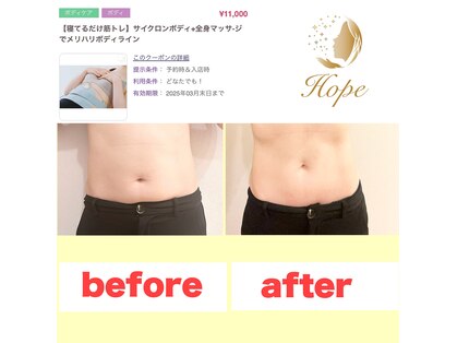 ホープ(Hope)の写真