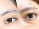 アルファシャルル(α.chalulu)の写真