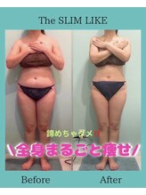 スリムライク 鳥取店(The SLIM LIKE)/痩身ビフォーアフター