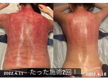 フェリーチェ(felice)/セル分解ビフォーアフター