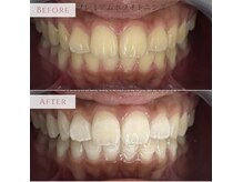 プティー(putih)の雰囲気（自分史上最高な美歯を♪メンズ利用も可です）