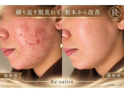 アールイーサロン(Re:salon)の写真