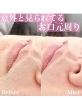 パルミエ(Palmier)/意外と見られている口元