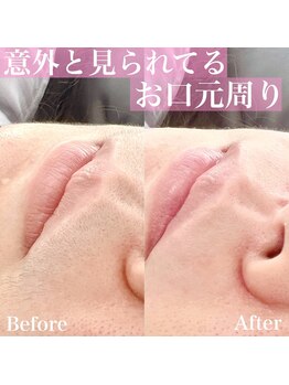 パルミエ(Palmier)/意外と見られている口元