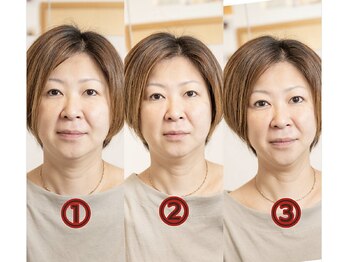 北梅田美容鍼灸院/【大阪/梅田】ビフォーアフター