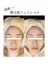 マノマノ エミュー(manomano emu)/【艶玉肌フェイシャル】