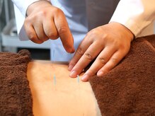 鍼灸院ネクストステップ(鍼灸院NextStep)/全身調整鍼《腰痛》