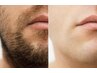 【男性限定】眉Waxstyling＋お髭顔脱毛（Wax と光どちらも選べます♪）