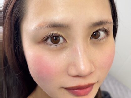 エイジレス(AGELESS)の写真