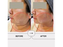 レミュービューティー(Remieux beauty)の雰囲気（WINBACKフェイシャルで気になるたるみを改善！首回りもスッキリ）