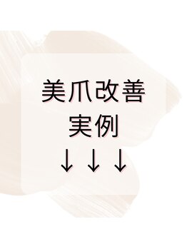 パールズ(PEARLS)/