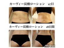 ティーダ(Ti-Da)の雰囲気(ミトコンドリア×自律神経着目♪リトハピカーヴィ炭酸★痩せケア)