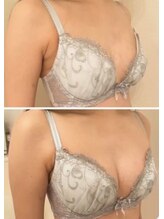 スマイルクルー(SmileClue)/ビフォーアフター症例