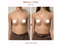 サロン ド ミミ(salon de mimi)の雰囲気（短期間＆都度払いで驚きのバストアップ☆）