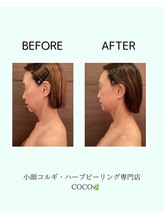 ココ 広島店(COCO)/50代　顔肩凝り