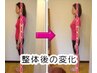 【猫背矯正コース 30分】初回カウンセリング+施術　初回8000円→2980円