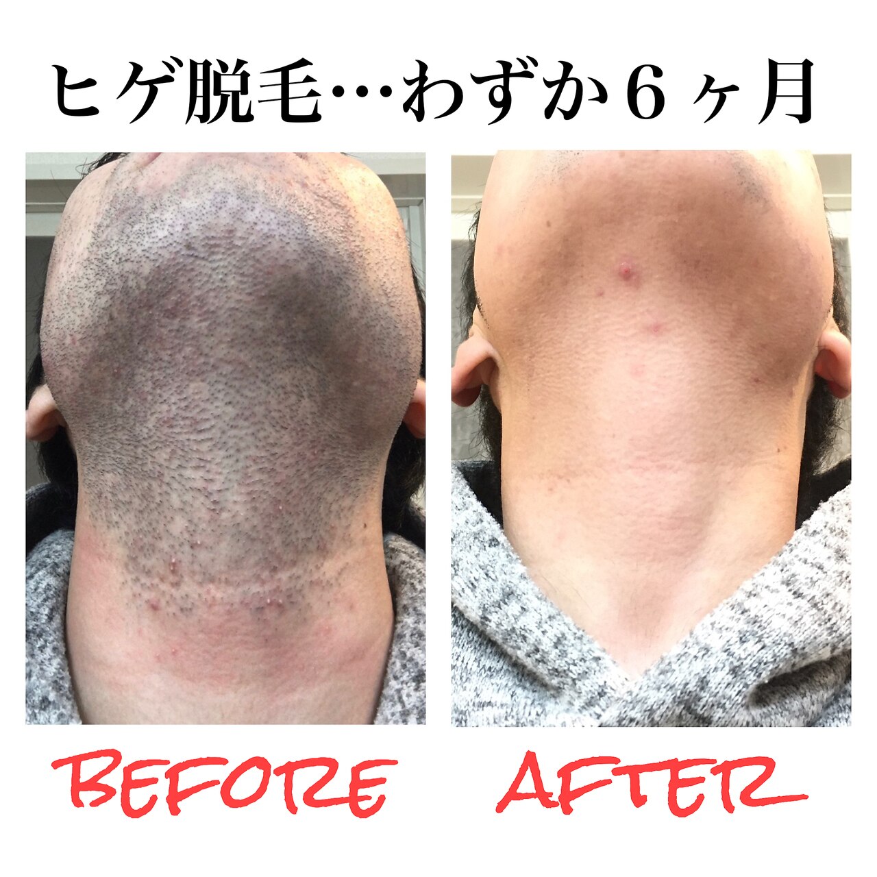 アプロディタ｜ホットペッパービューティー