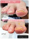 巻き爪ジェル★ケアメニューに+