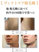 ベルカーラ(Belcarra) 本物の 脱毛☆