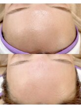 ノート(note)/フェイシャルワックス《宇都宮》