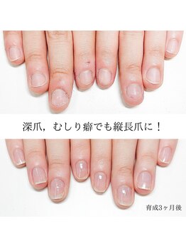 ルクレール カシェット(Le clair cachette)/美爪育成ケアコース