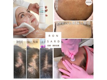 ロンサール(RONSARD)