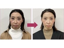 ゲラン(GELAN)の雰囲気（小顔矯正。中顔面短縮。整体、美容整顔、コルギの前に骨矯正）