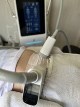 リバウンド知らず！最新【脂肪冷却】で理想ボディへ