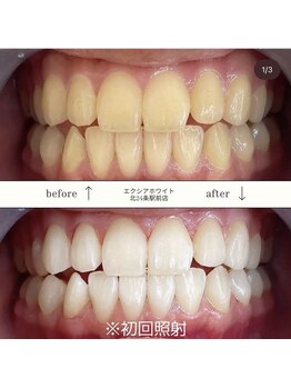 エクシアホワイト 北24条駅前店/