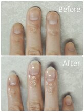 アウラ ネイル ファクトリー(aura nail factory)/深爪矯正スカルプ長さ出し自爪風
