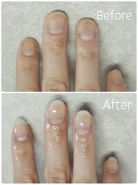 深爪矯正スカルプ長さ出し自爪風